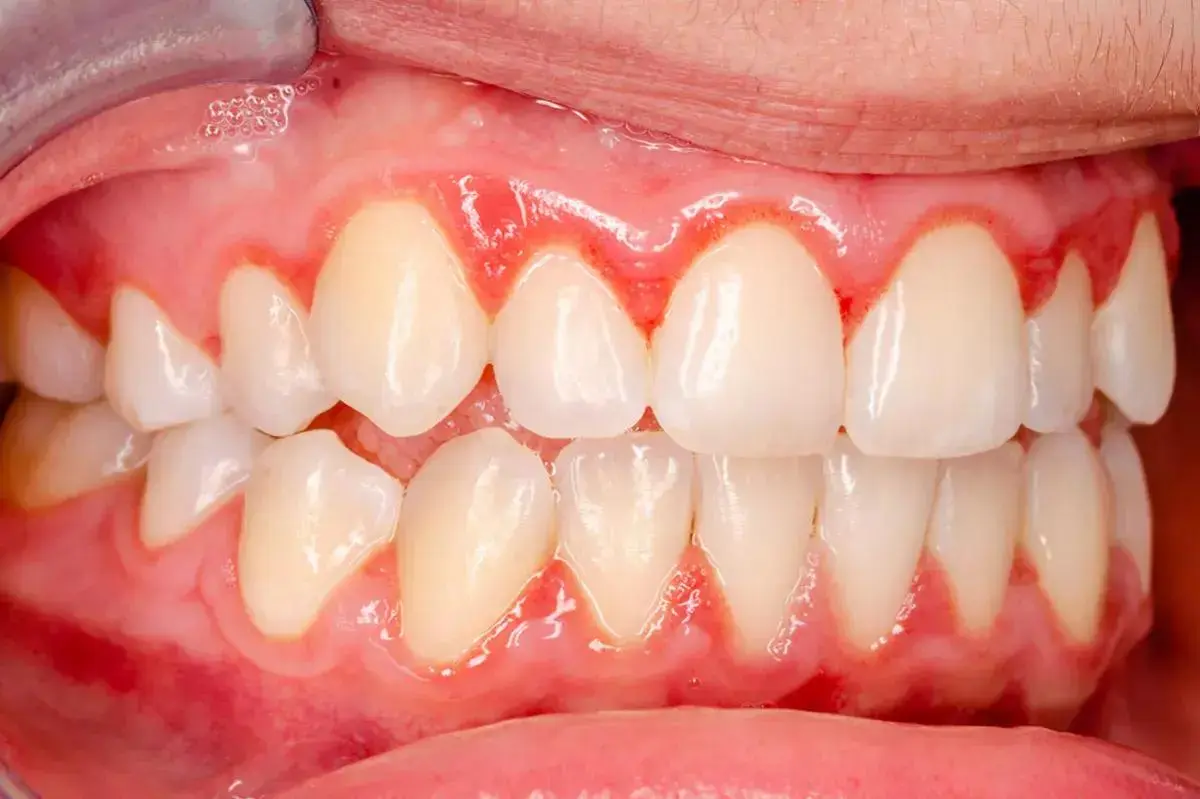 DentLink